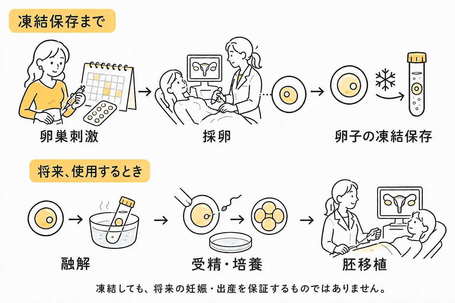 卵巣刺激から採卵・卵子凍結保存までと、将来使用する際の融解・受精・培養・胚移植の流れ